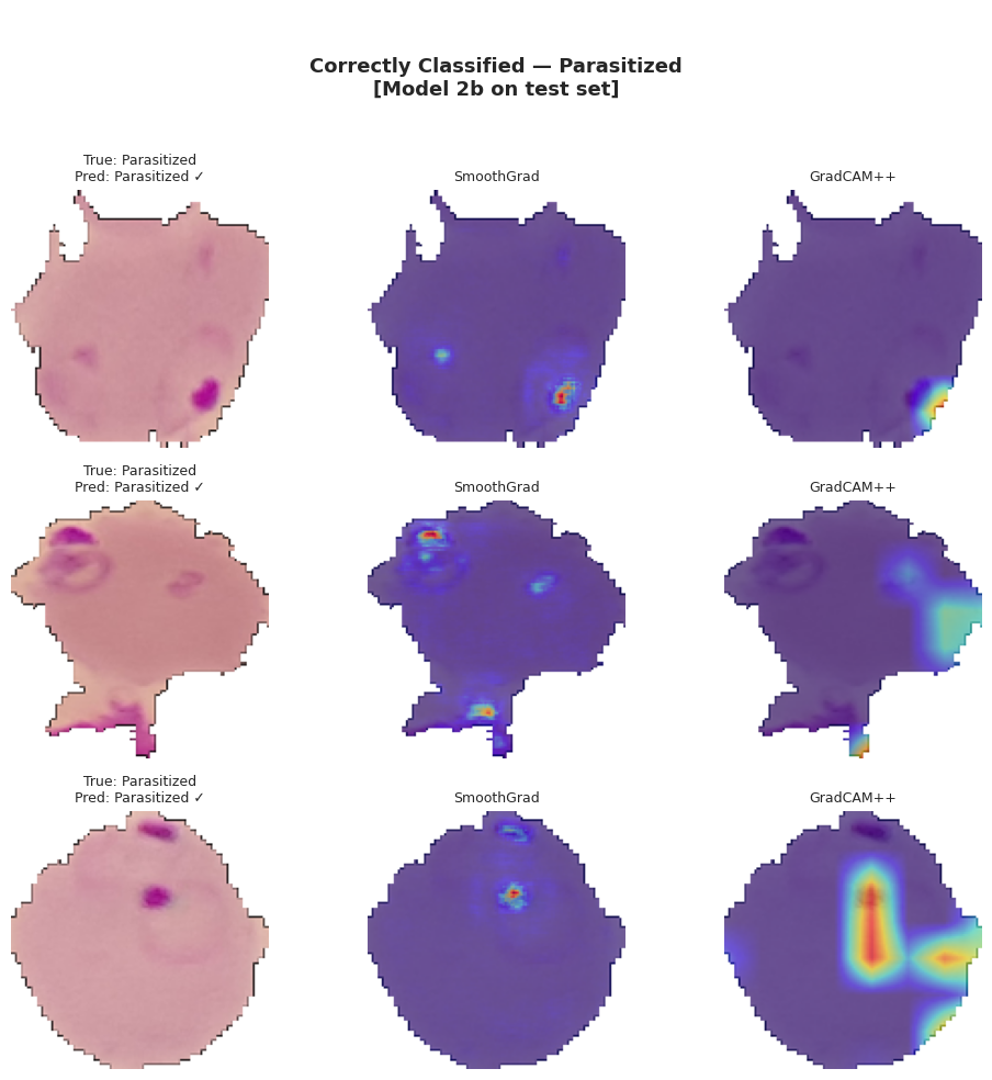 GradCAM++ und SmoothGrad Saliency-Karten von Model 2b auf parasitierten Blutzellen